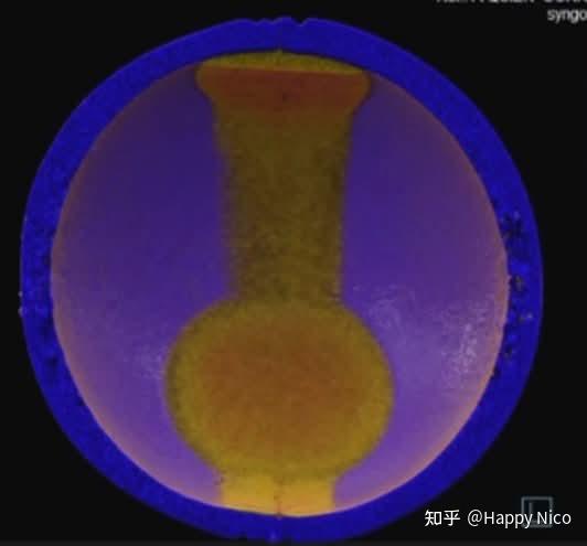 Buga Sphere X-ray