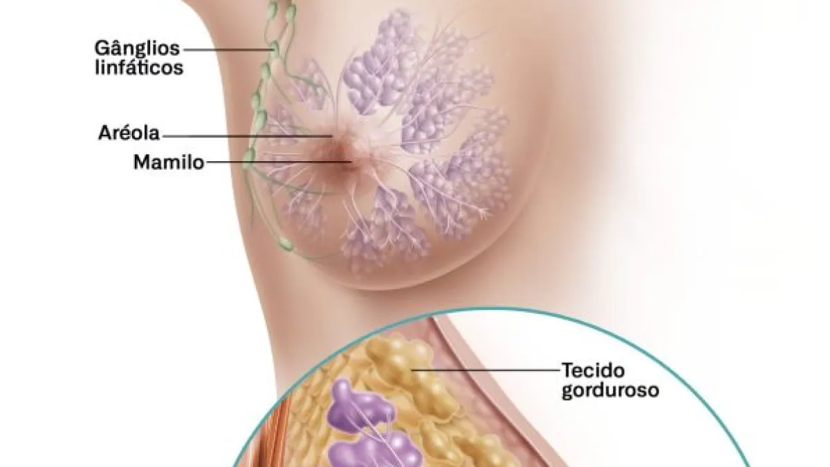 Ferramenta combina dados clínicos com algoritmos para estimar risco individual da doença